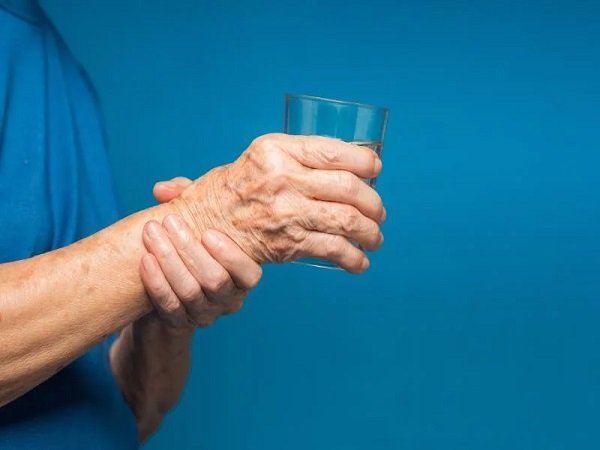 Movement Disorders